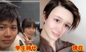 Mattの整形前と今とが違い過ぎてオワタ 本人は整形説を否定するもかなり怪しい 暇人たちの井戸端会議