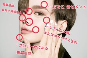 Mattの整形前と今とが違い過ぎてオワタ 本人は整形説を否定するもかなり怪しい 暇人たちの井戸端会議