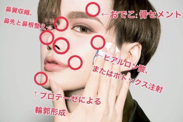 Mattの整形前と今とが違い過ぎてオワタ 本人は整形説を否定するもかなり怪しい 暇人たちの井戸端会議